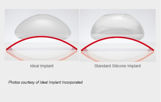 Side view of Ideal Implant beside standard silicone implant showing similar shape